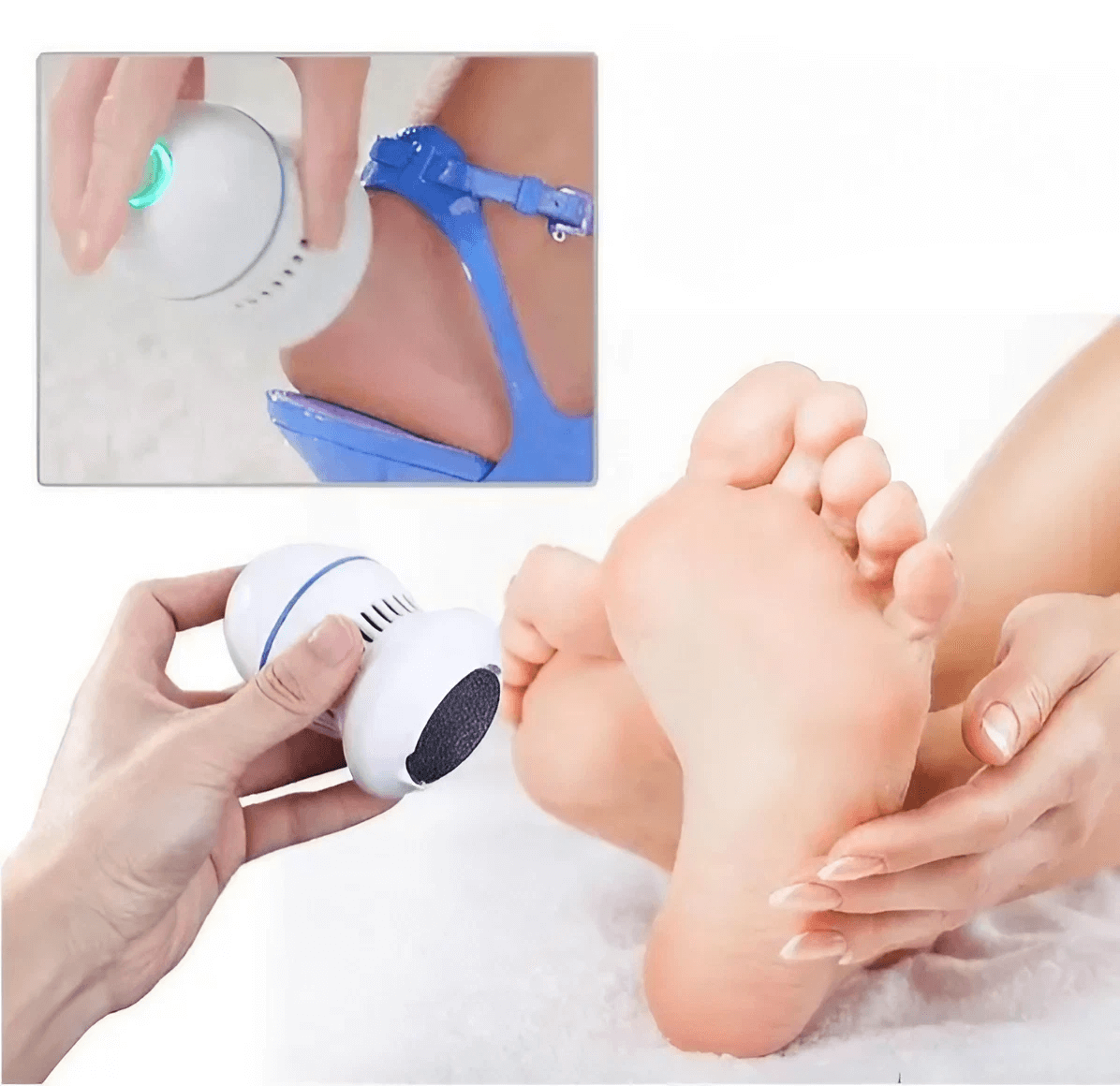 Electric Dead Skin Remover