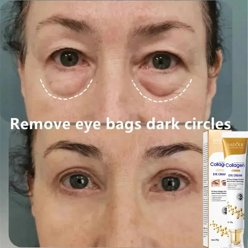 Instant Eye Bag Removal - Smart Shop (Online Store for wise shoppers) 