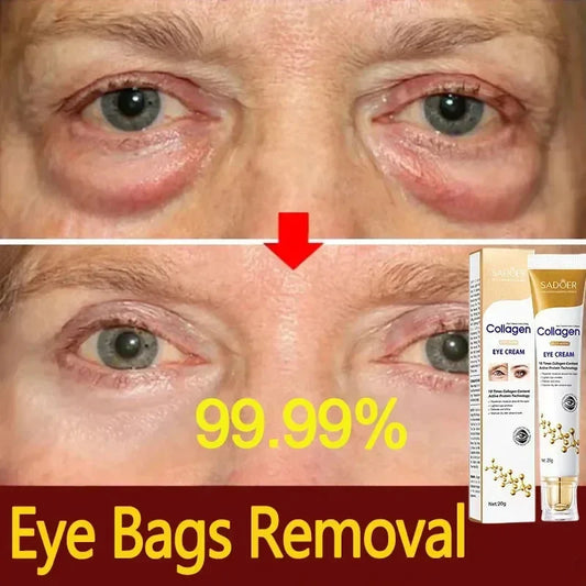 Instant Eye Bag Removal - Smart Shop (Online Store for wise shoppers) 