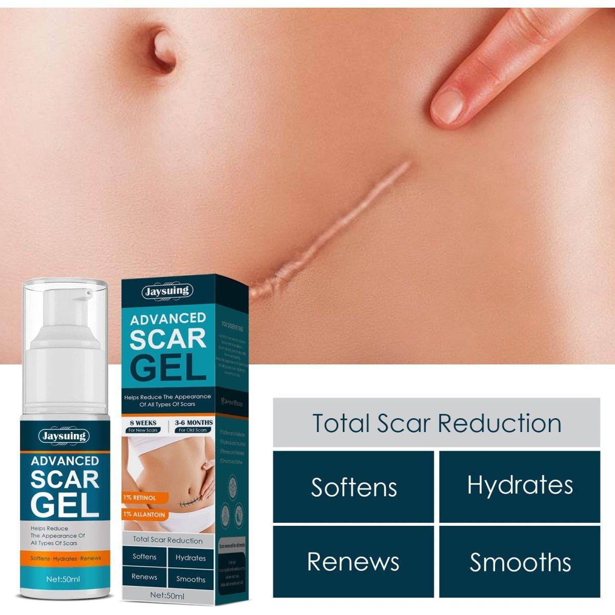 ScarAway®100% Advanced Scar Gel, C-Section Scars, Tummy Tuck, Old Scars, Keloids, Stretch Marks, Burn Scars - Smart Shop (Online Store for wise shoppers) 