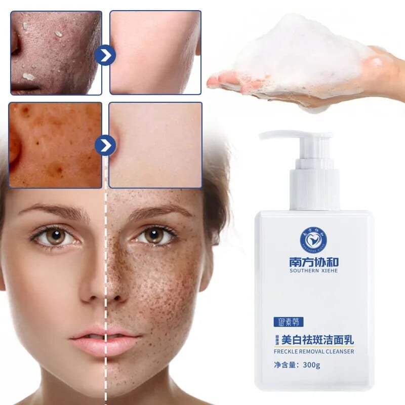 SearchFindOrder 300g 300g Whitening And Freckle Removing Radiance Renewal Foam Cleanser with Nicotinamide