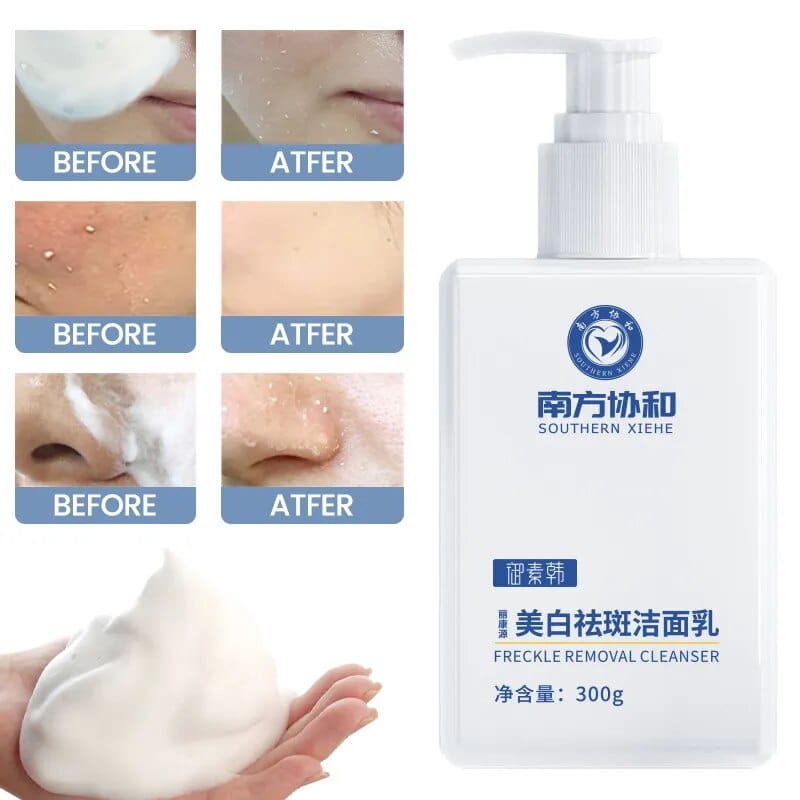 Whitening and Freckle Removing Radiance Renewal Foam Cleanser with Nicotinamide