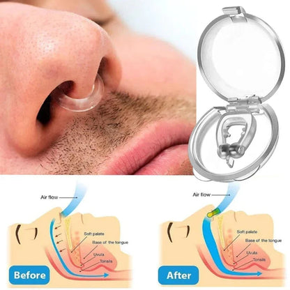 SearchFindOrder 4pcs Anti-Snoring Nose Clip