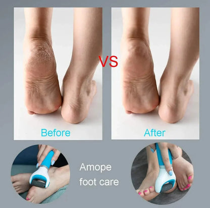 Electric Foot Callus Remover - Pedicure Tool for Dry, Cracked Heels and Feet Care, Wet/Dry Callus Shaver and File, Foot Spa Pedicure for Heel Callus Removal