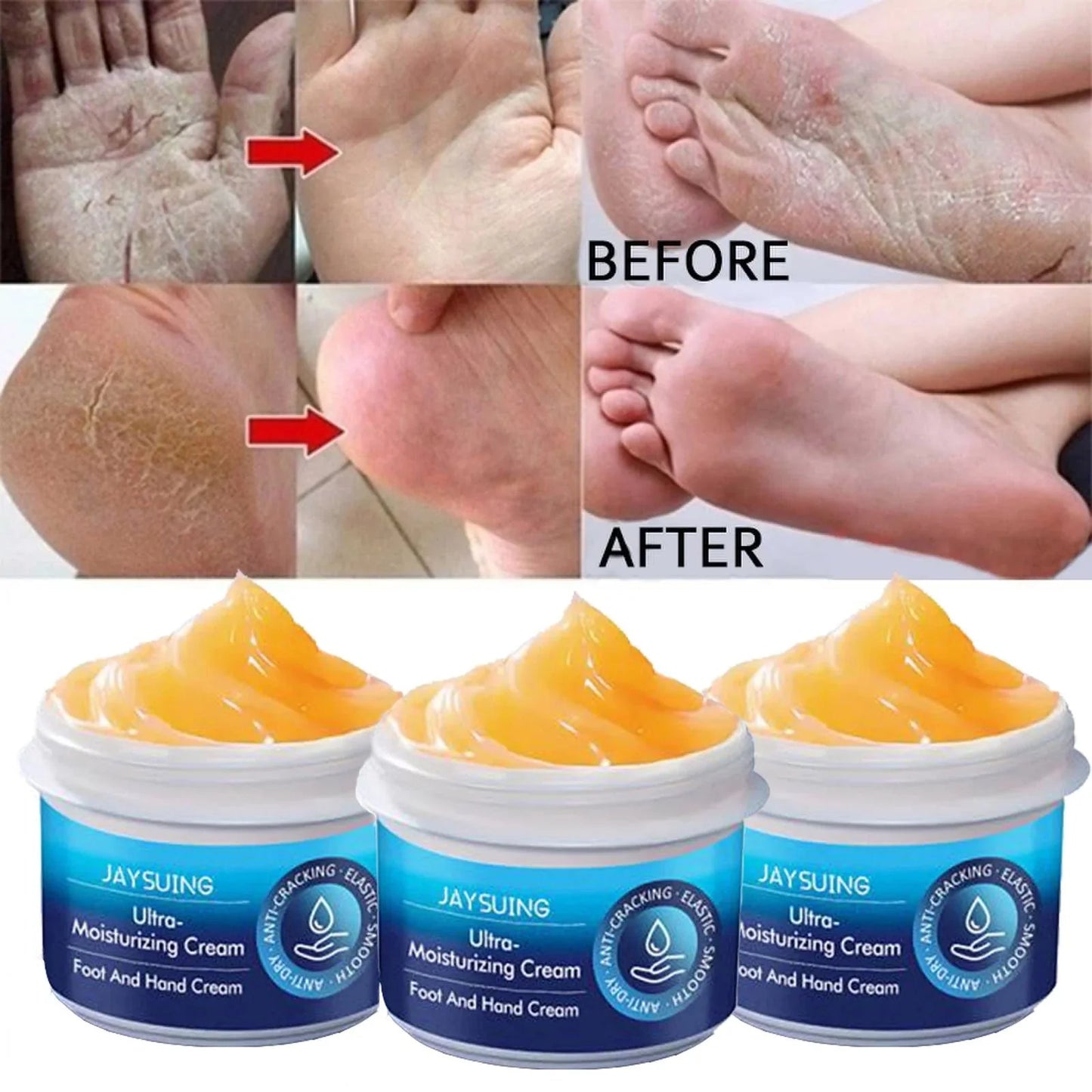 Moisturizing Dry Dead Skin Removal Skin Cream