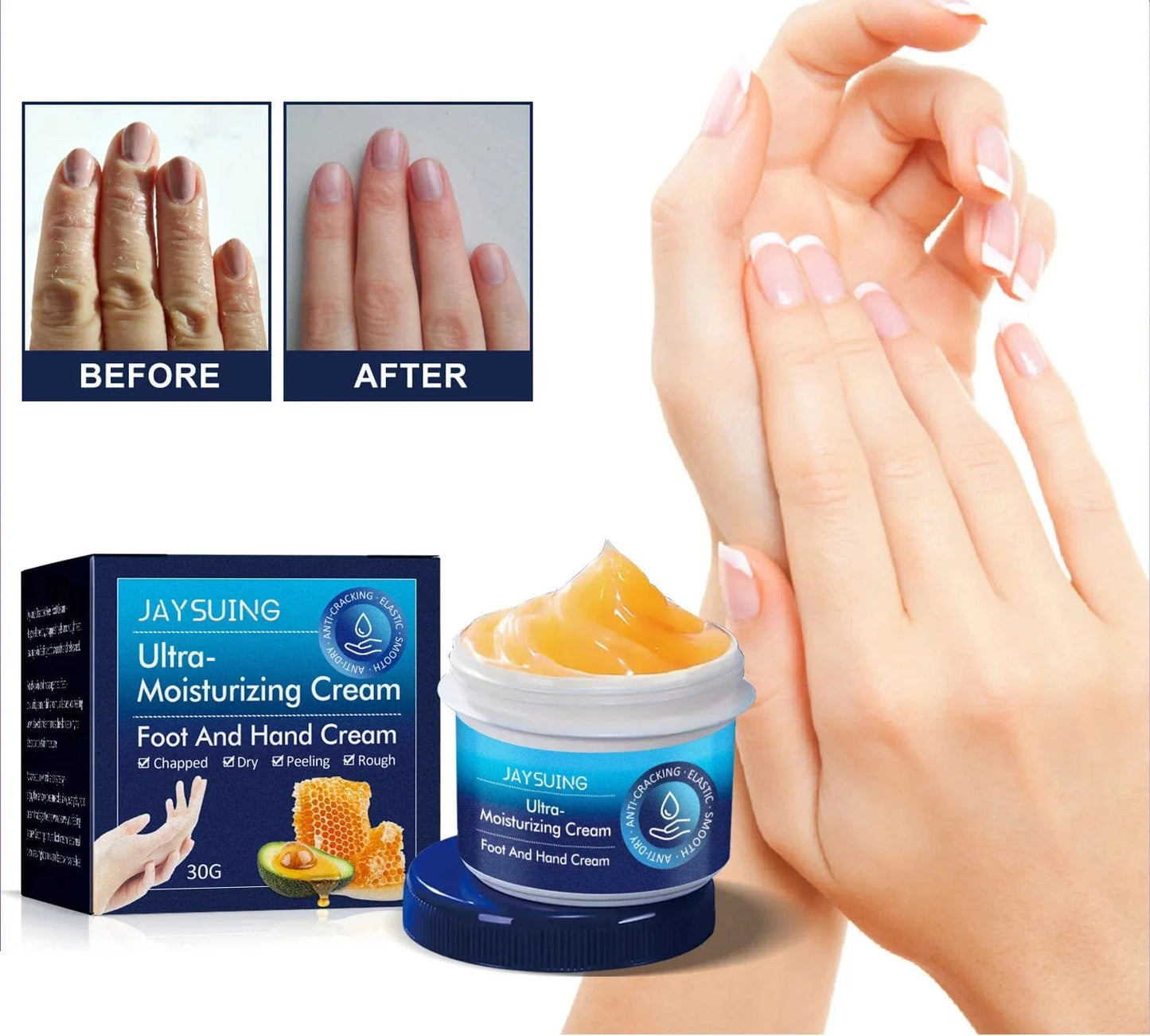 Moisturizing Dry Dead Skin Removal Skin Cream