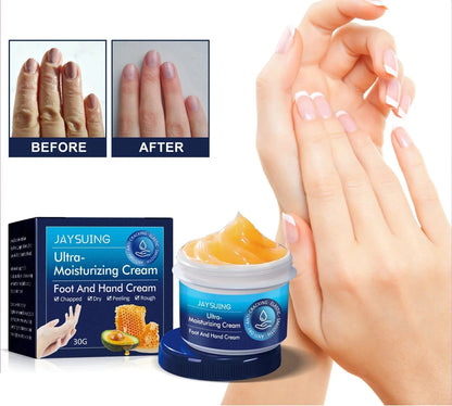 Moisturizing Dry Dead Skin Removal Skin Cream