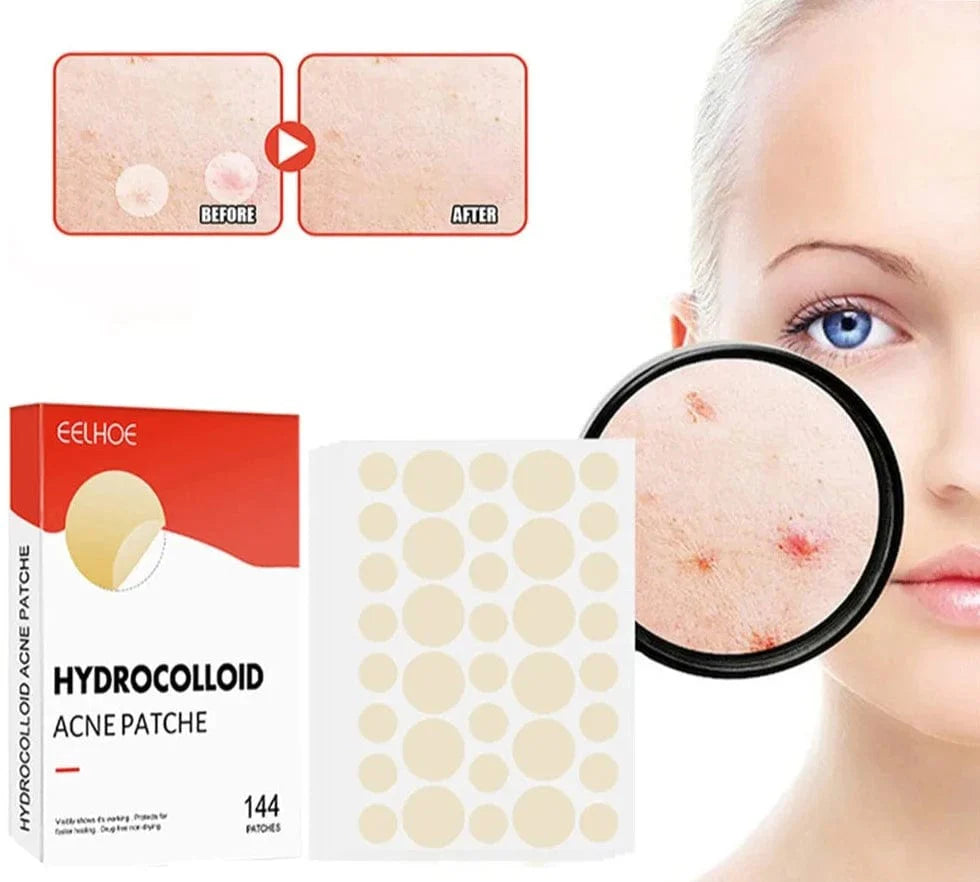 SearchFindOrder 144pcs Skin Clear Pro 144-Piece Acne Pimple Patch Set for Invisible Healing and Spot Coverage