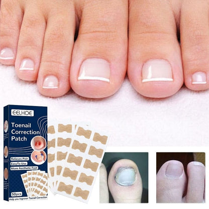 SearchFindOrder The Ultimate Paronychia Toenail Treatment and Pedicure Recovery Tool (50 pcs)