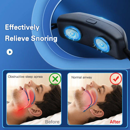 Smart Anti-Snoring Sleep Apnea Relief EMS Device - Smart Shop (Online Store for wise shoppers) 