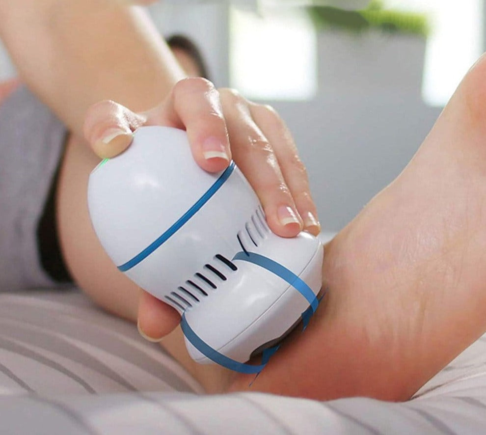 Vacuum Callus Remover