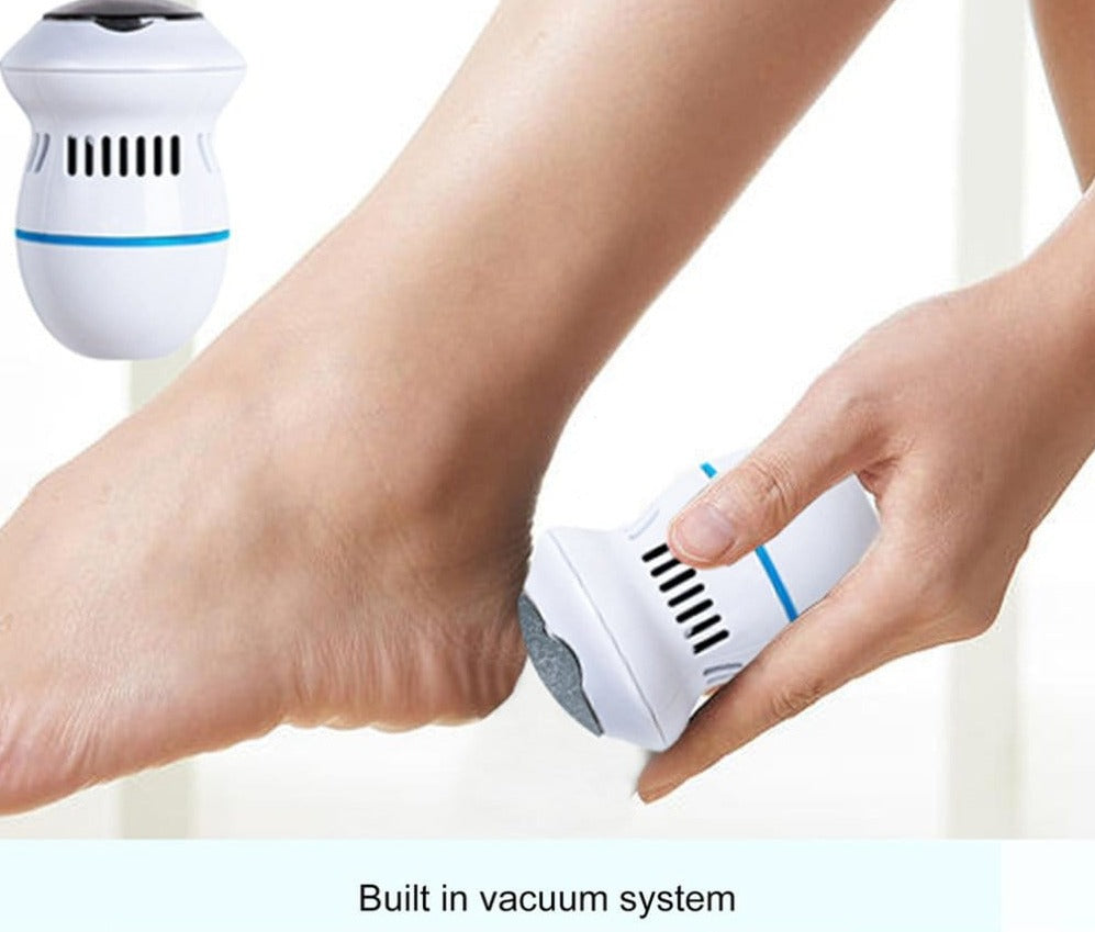 Vacuum Callus Remover