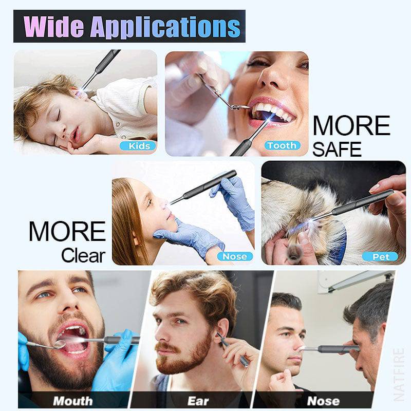 Wireless Otoscope Ear Wax Removal Tool, 1080P HD Ear Cleaner with 6 LED Lights, 3.5mm Mini Visual Ear Camera Endoscope, Ear Cleaning Kit for iPhone, iPad, Android - Smart Shop (Online Store for wise shoppers) 