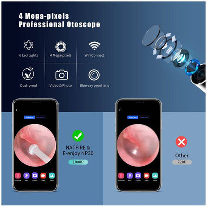 Wireless Otoscope Ear Wax Removal Tool, 1080P HD Ear Cleaner with 6 LED Lights, 3.5mm Mini Visual Ear Camera Endoscope, Ear Cleaning Kit for iPhone, iPad, Android - Smart Shop (Online Store for wise shoppers) 