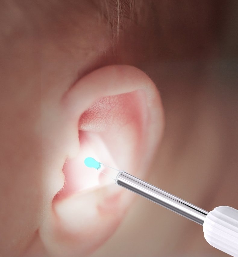 Otocam™ Ear Cleaner With Camera