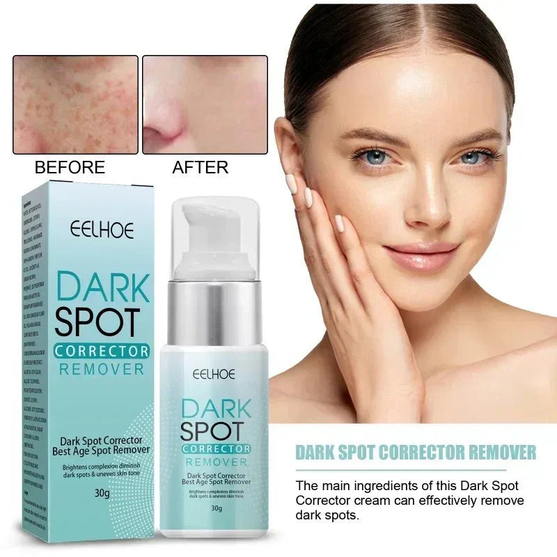 Techanova ™ - Dark Spot Corrector Remover - Smart Shop (Online Store for wise shoppers) )