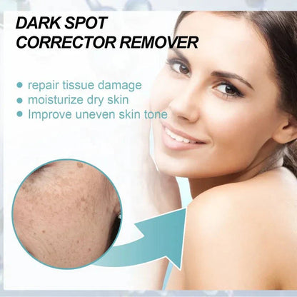 Techanova ™ - Dark Spot Corrector Remover - Smart Shop (Online Store for wise shoppers) )