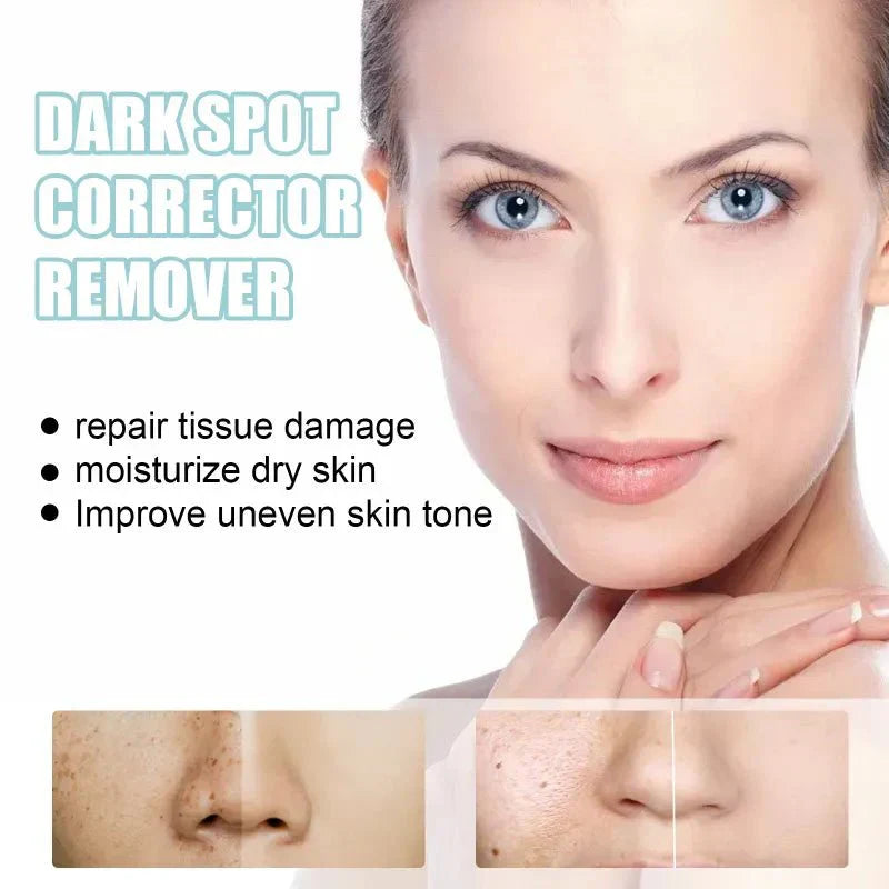 Techanova ™ - Dark Spot Corrector Remover - Smart Shop (Online Store for wise shoppers) )