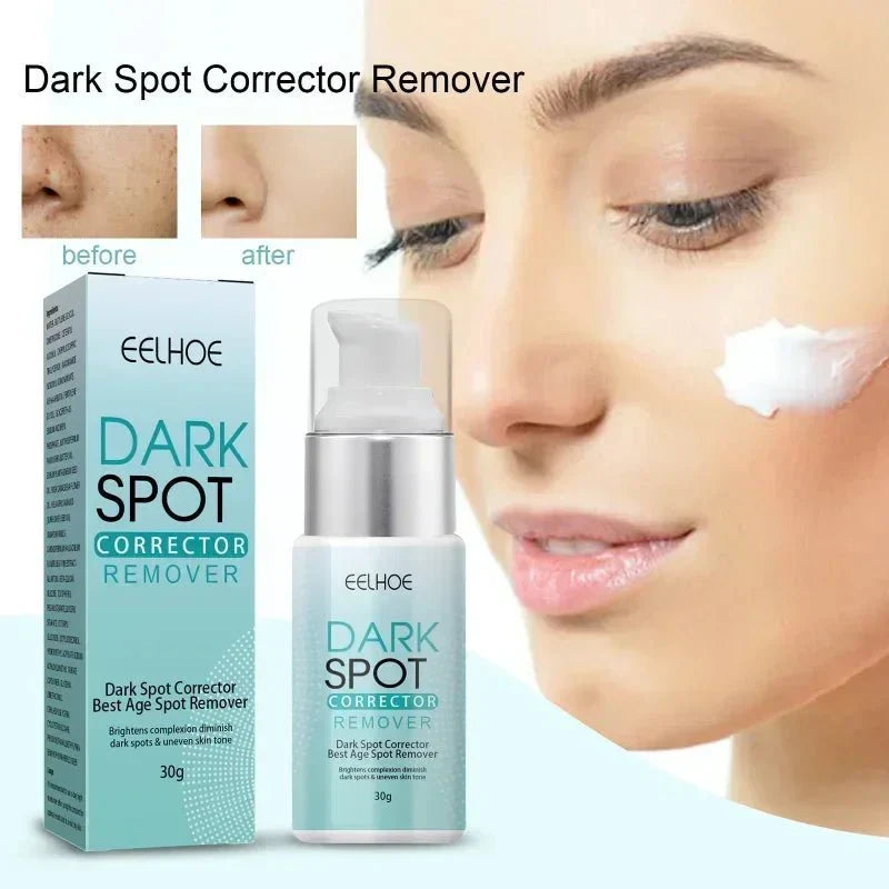 Techanova ™ - Dark Spot Corrector Remover - Smart Shop (Online Store for wise shoppers) )